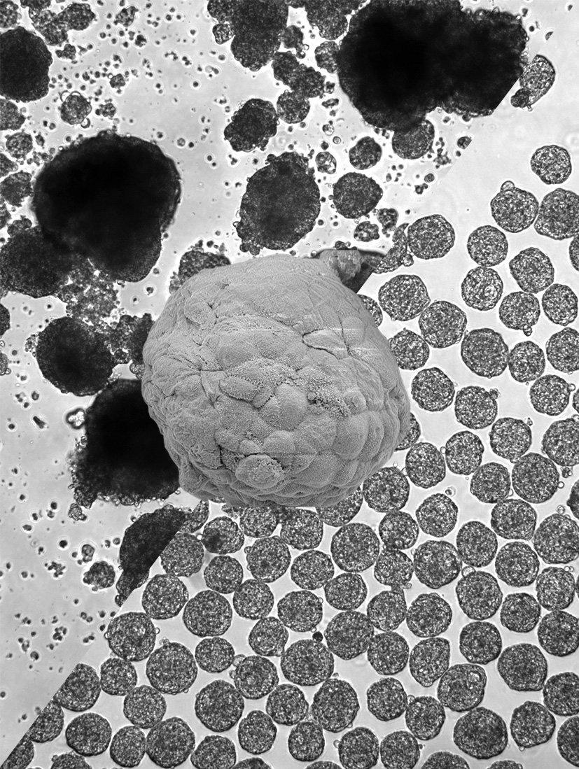 Light micrographs of human islets (top-left) and engineered human pseudoislets (bottom-right), with an electron micrograph of a single human pseudoislet centred.