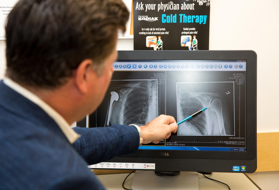 Richard Boorman shows X-ray of shoulder.