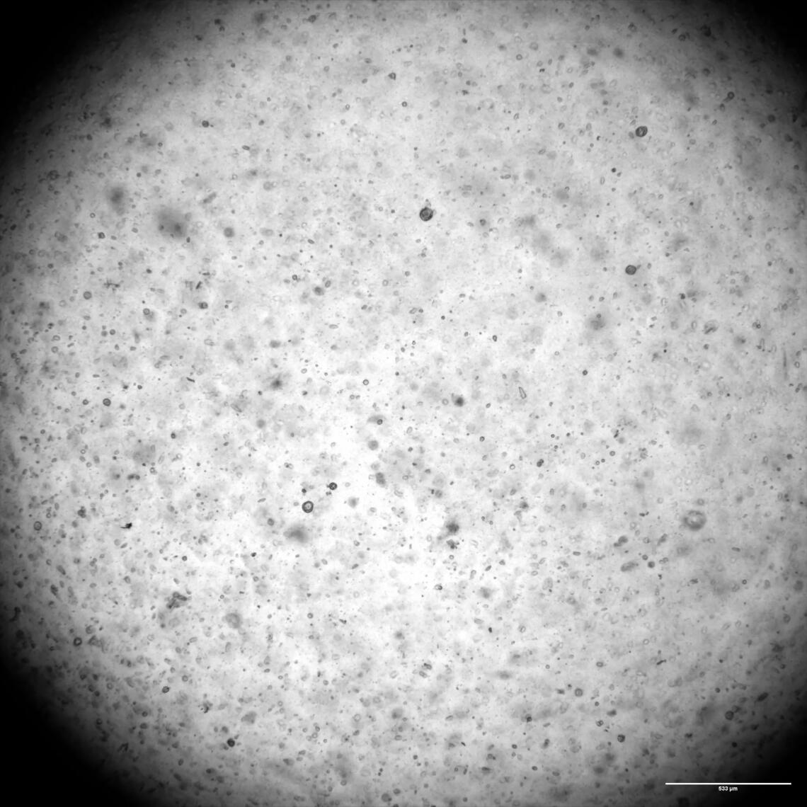 A black and white image of a sample through a telescope