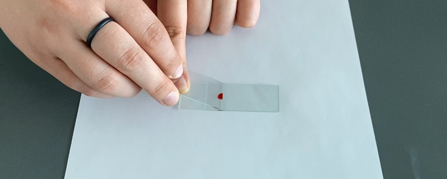 Blood Smear