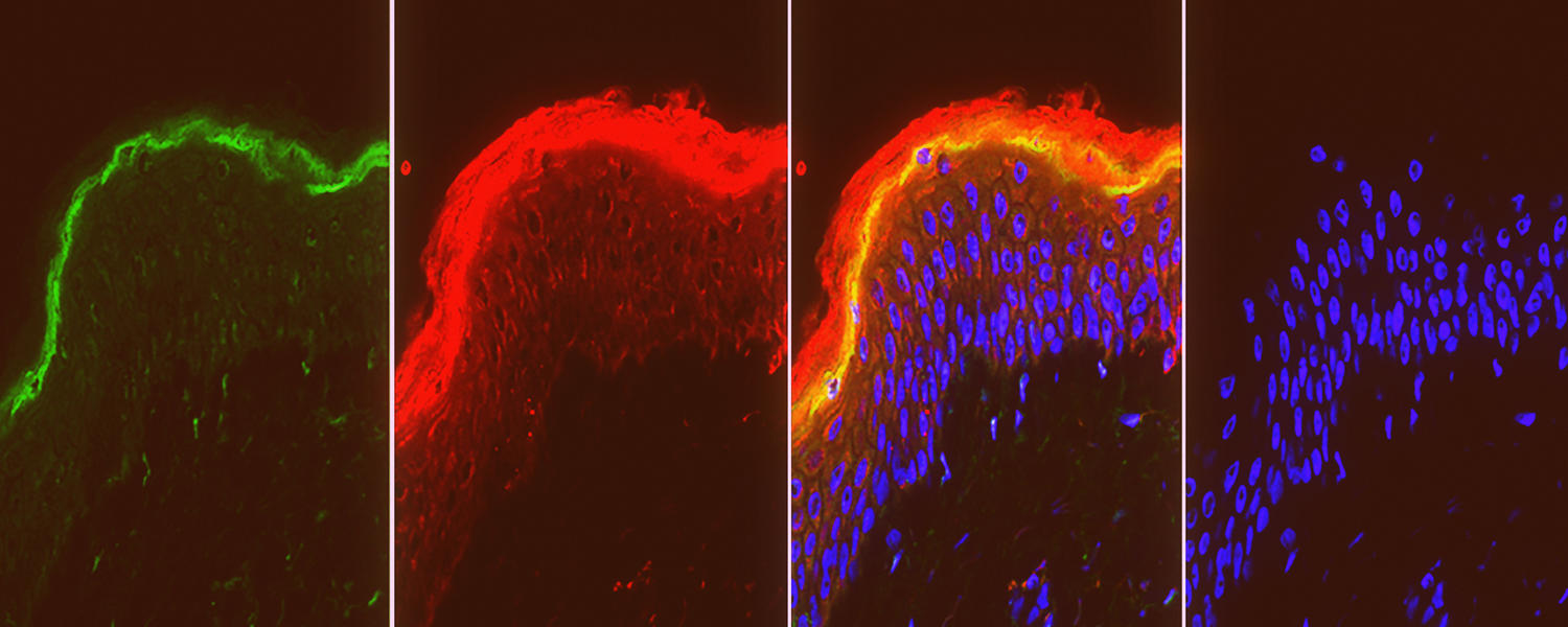 Skin Regeneration Team