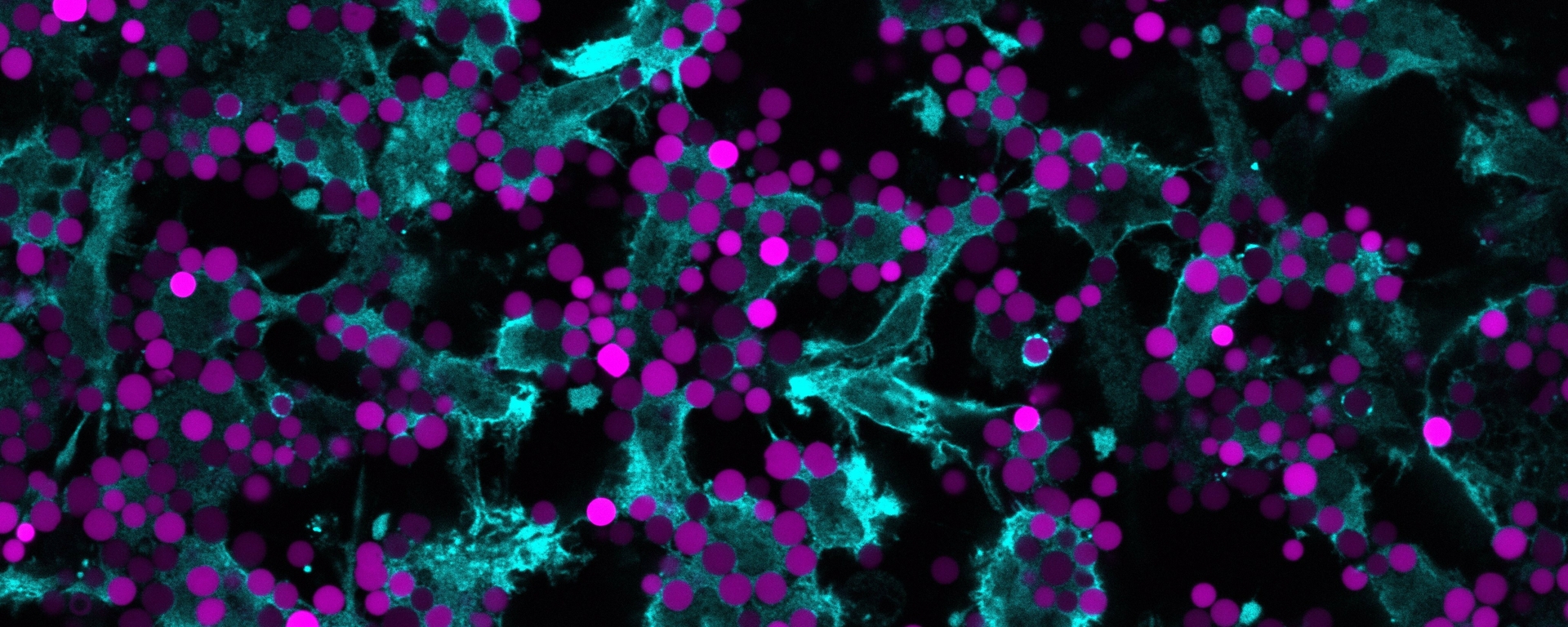 Immune cells phagocytosing Beads