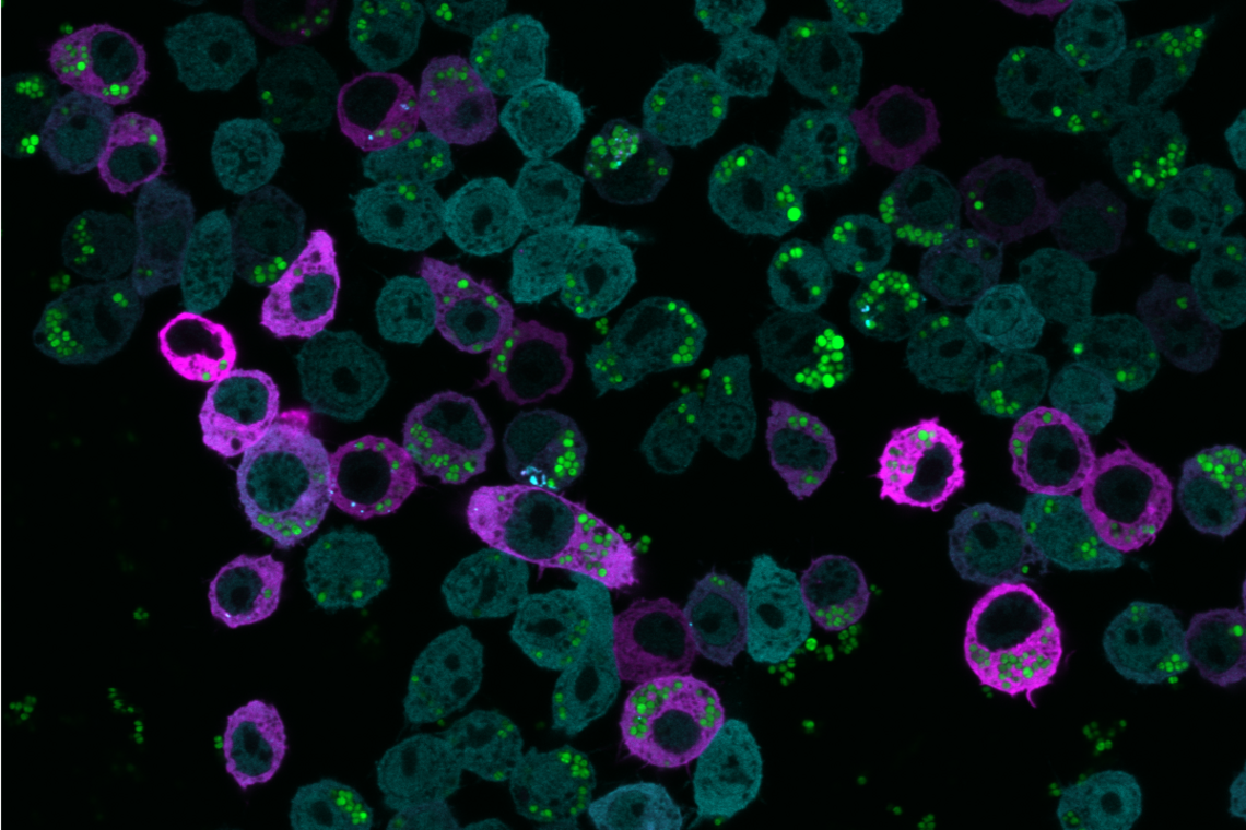 Immunofluorescence image of macrophages phagocytosing bacteria
