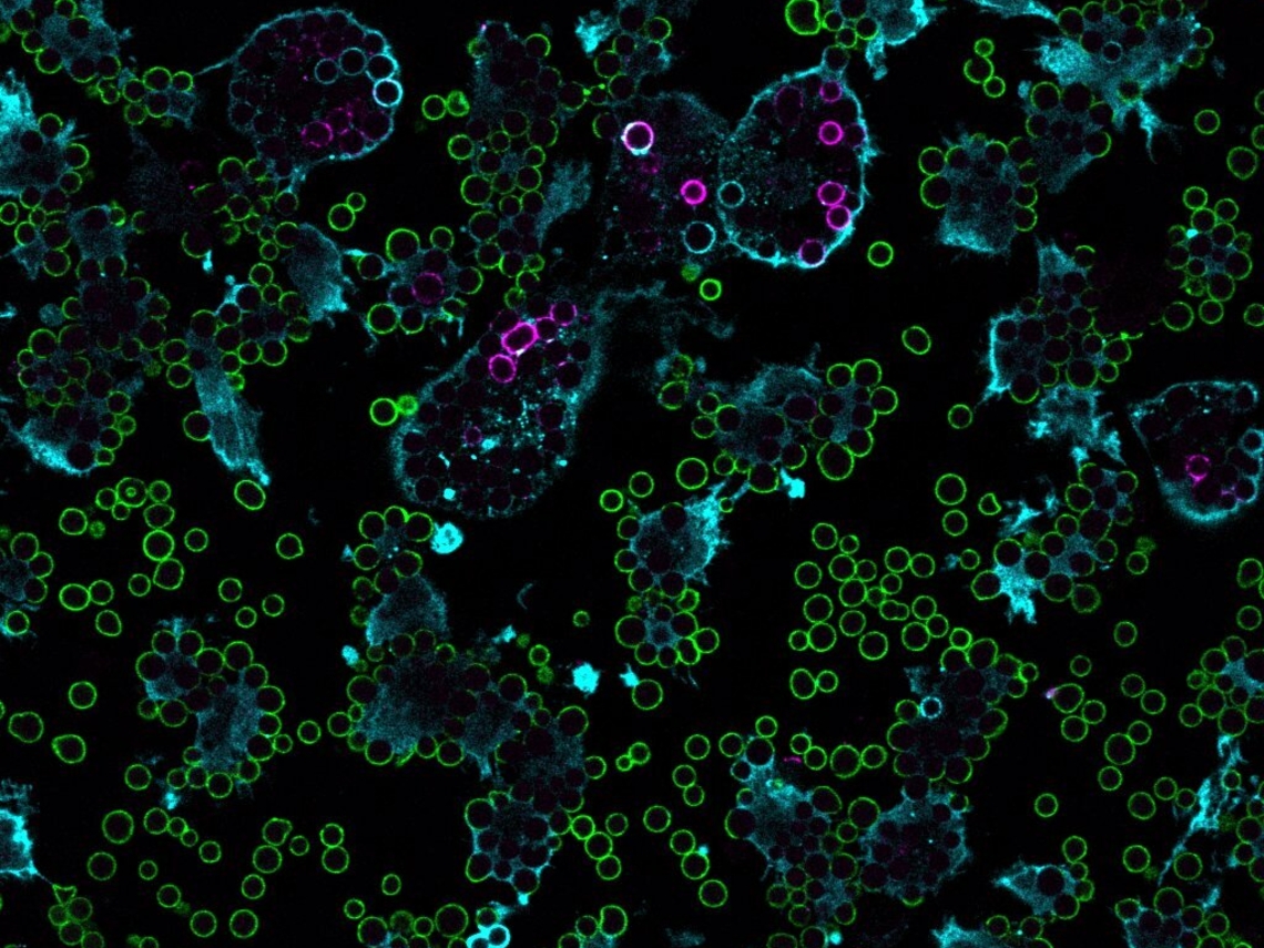Immunofluorescence image of Dendritic cells phagocytosing beads. 
