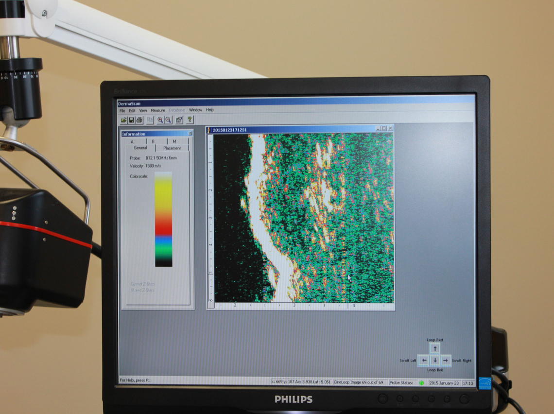 DermaScan C
