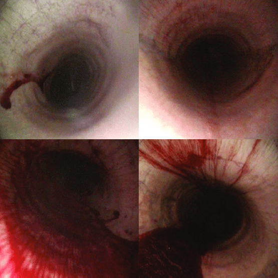 Exercise Induced Pulmonary Hemorrhage (EIPH) in Barrel Racing Horses