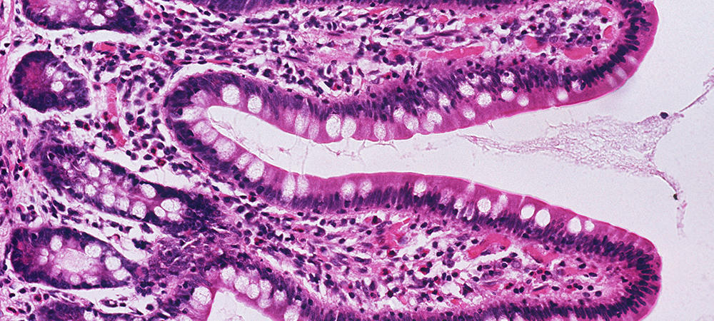 Top 10 non communicable diseases in the philippines 2020 picture