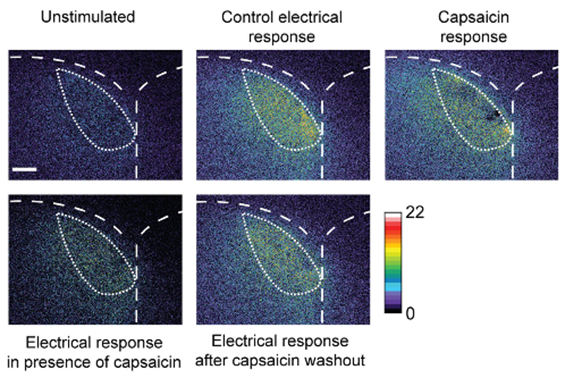 Calcium Imaging