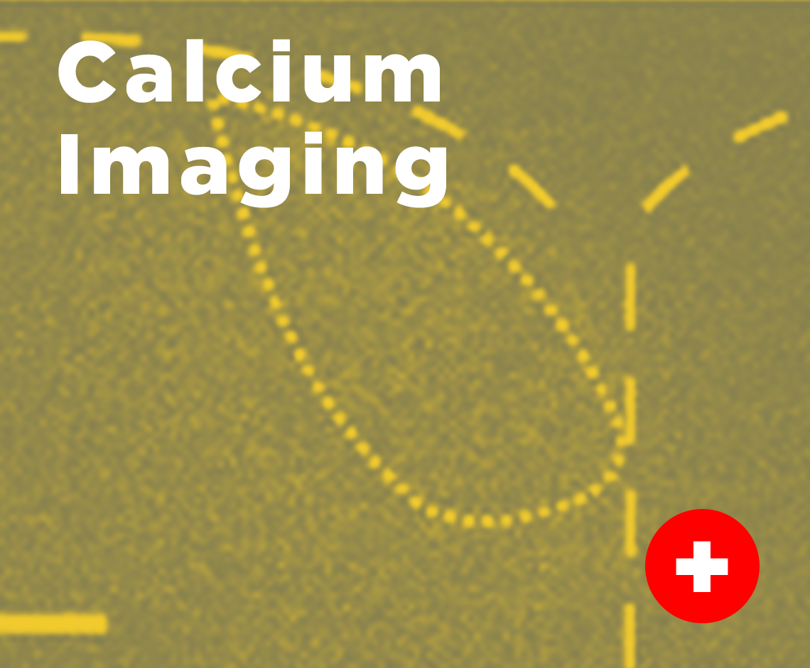 Calcium Imaging