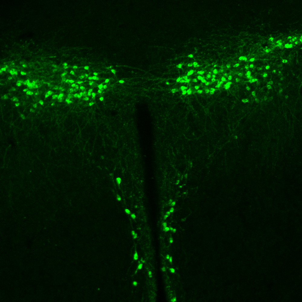 Neuroanatomical Identification of Locomotor Structures