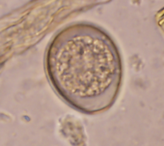 Figure 4: Oocysts of Coccidia seen under the microscope