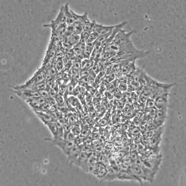 A colony of undifferentiated human ESCs.