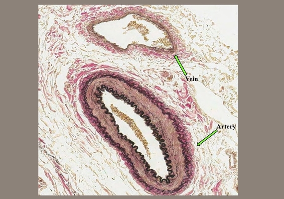 Blood Vessels