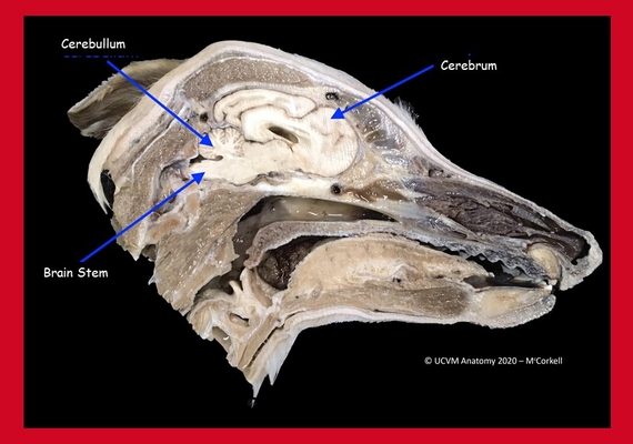 Brain