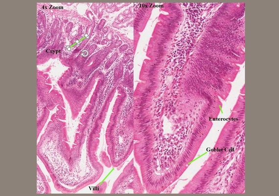 Duodenum