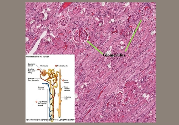 Kidney
