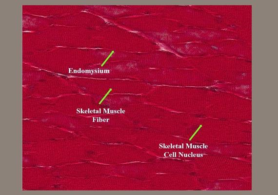 Skeletal Muscle