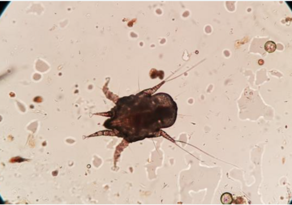 Ear mite retrieved from: https://cf-s3.petcoach.co/uploads/petcondition/28/1518715401-CatEarMites.jpg