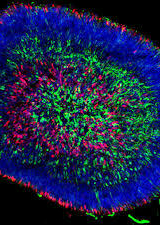 UCalgary research on pig and human genes relationship