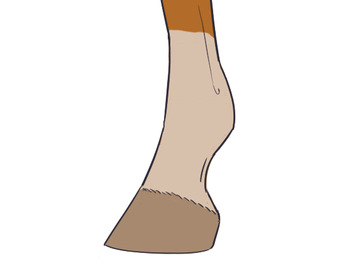 Sock