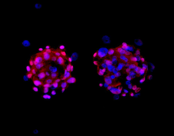 Cell aggregates stained with SOX2 (red) and Dapi (blue)