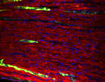 Nerve immunohistochemistry; red - fluoromyelin, green - alphaSMA, blue - nuclei